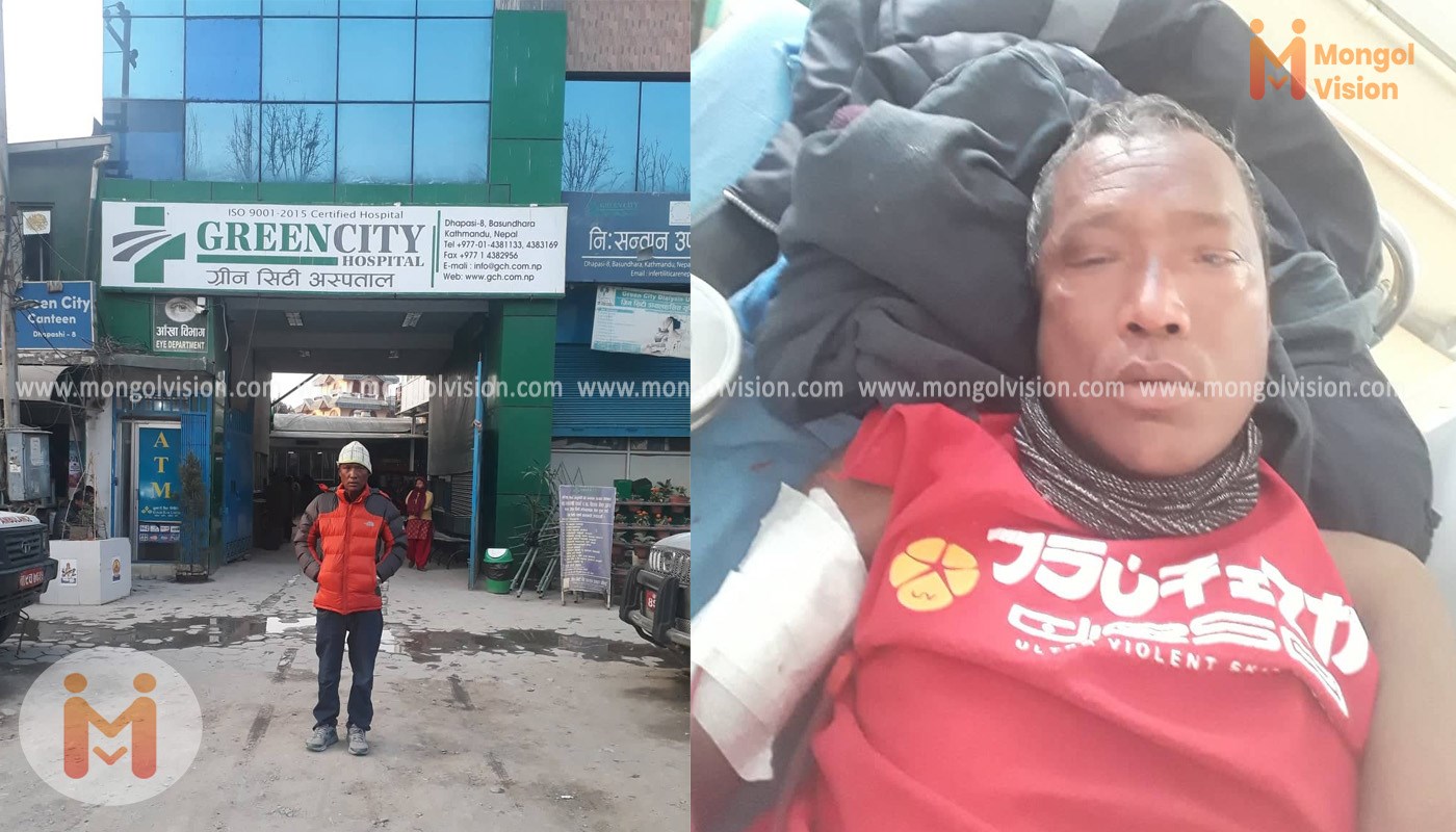 मृगौला रोगीलाई सहयोग